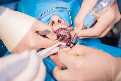 Oral Surgery & Minor Dental Procedures