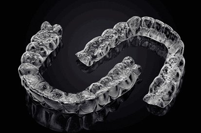 Aligners & Orthodontic Treatment