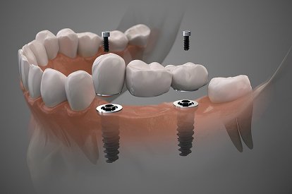 Restorative Dentistry